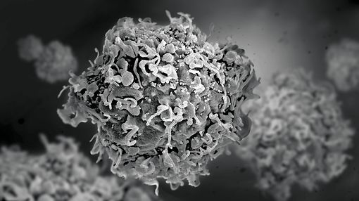 gettyimages-544541835-human-t-exhuastion-cytokine-profile-greyscale